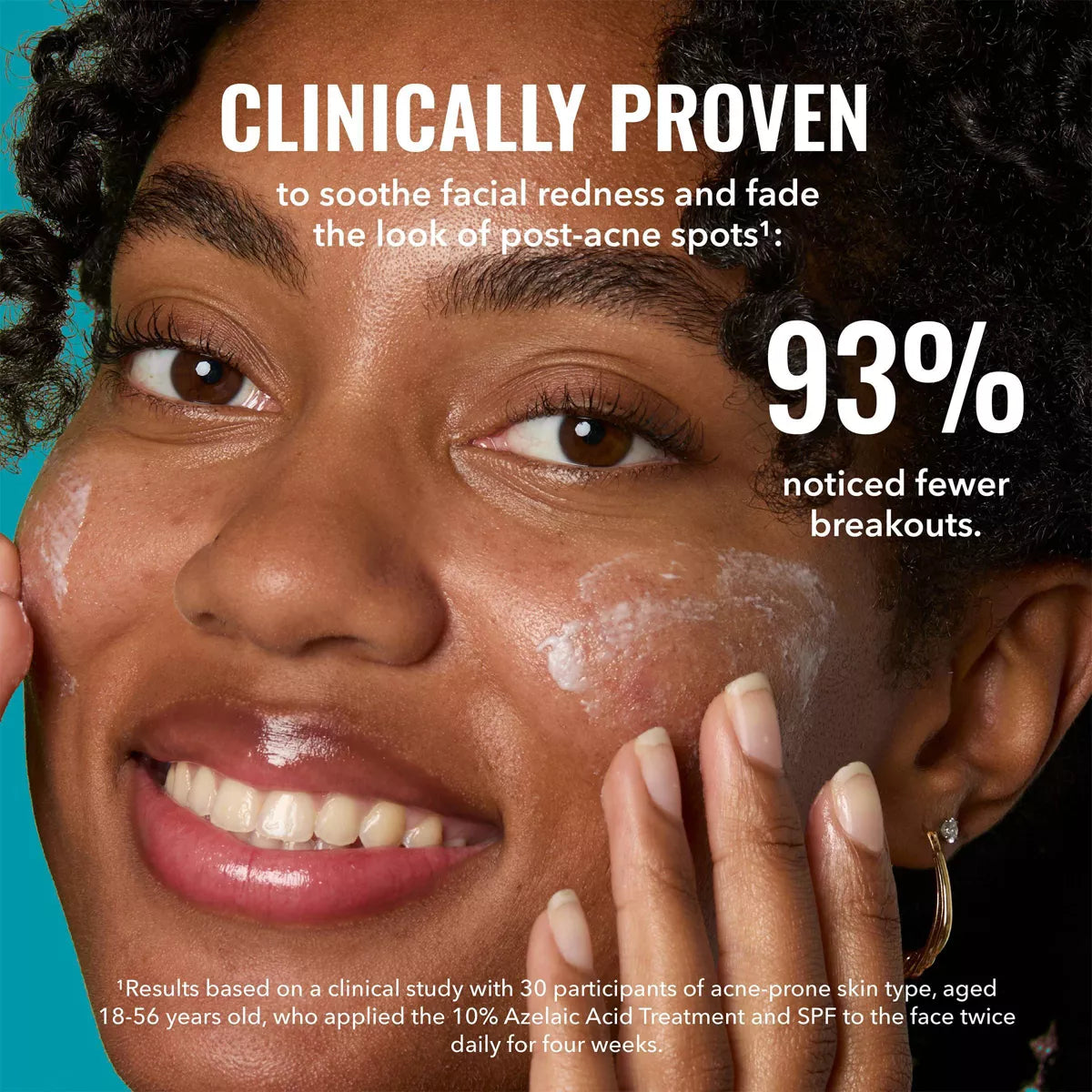 Good Molecules 10% Azelaic Acid Face Treatment - 30Ml: Skin Tone Improvement, Unscented, Liquid Form
